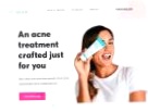 MDacne