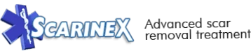 Scarinex